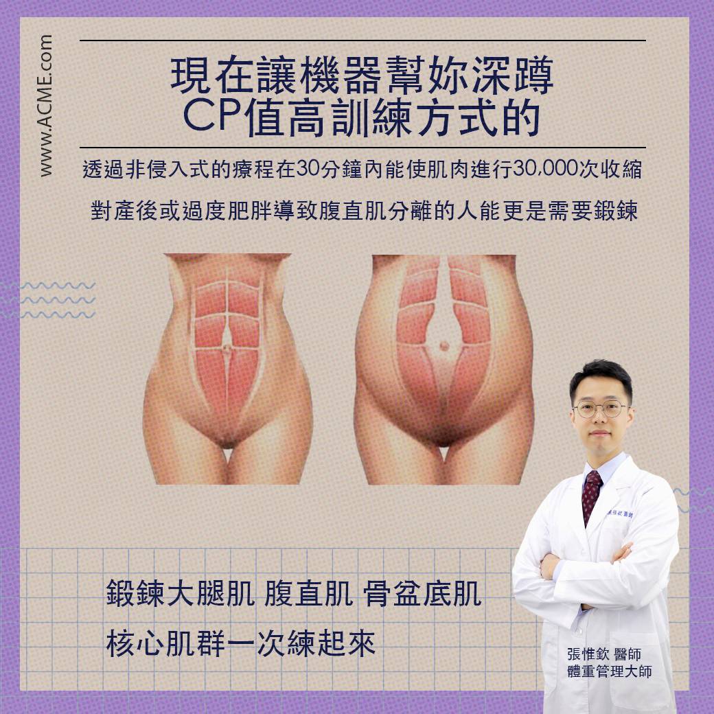增肌,訓練肌肉,增加肌肉,增肌減脂,核心肌群,強化肌肉,私密緊緻,膀胱鬆弛,漏尿,私密處鬆弛,肌肉緊實,強化盆底肌,盆底肌,腹直肌,產後婦女,產後漏尿,漏尿改善,尿失禁,大笑漏尿,咳嗽漏尿,打噴嚏漏尿,醫美改善漏尿,台北醫美推薦,台北整形外科醫師,整形外科醫師推薦,台北中山區醫美