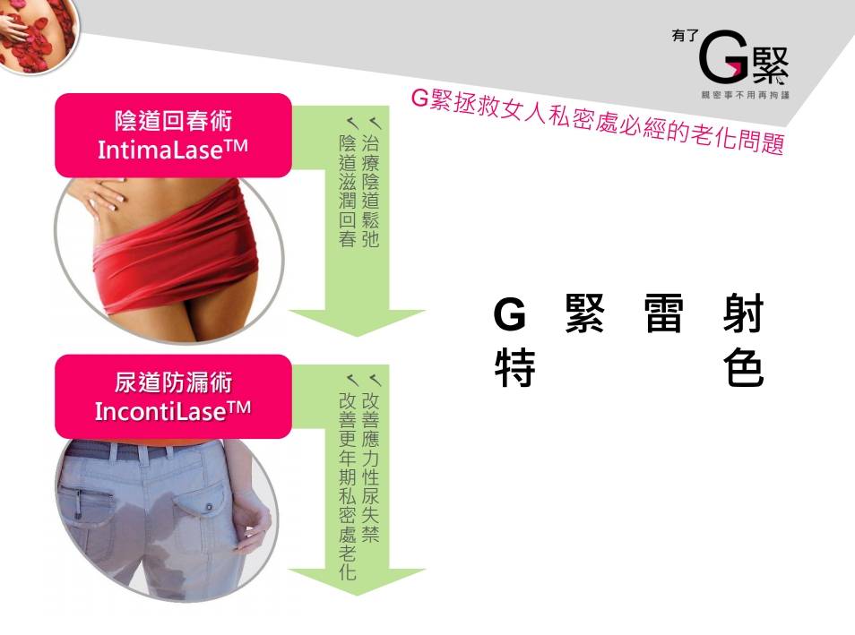 G緊雷射 免動刀的陰道緊實療程 高潮一波接一波 雅美姬時尚診所
