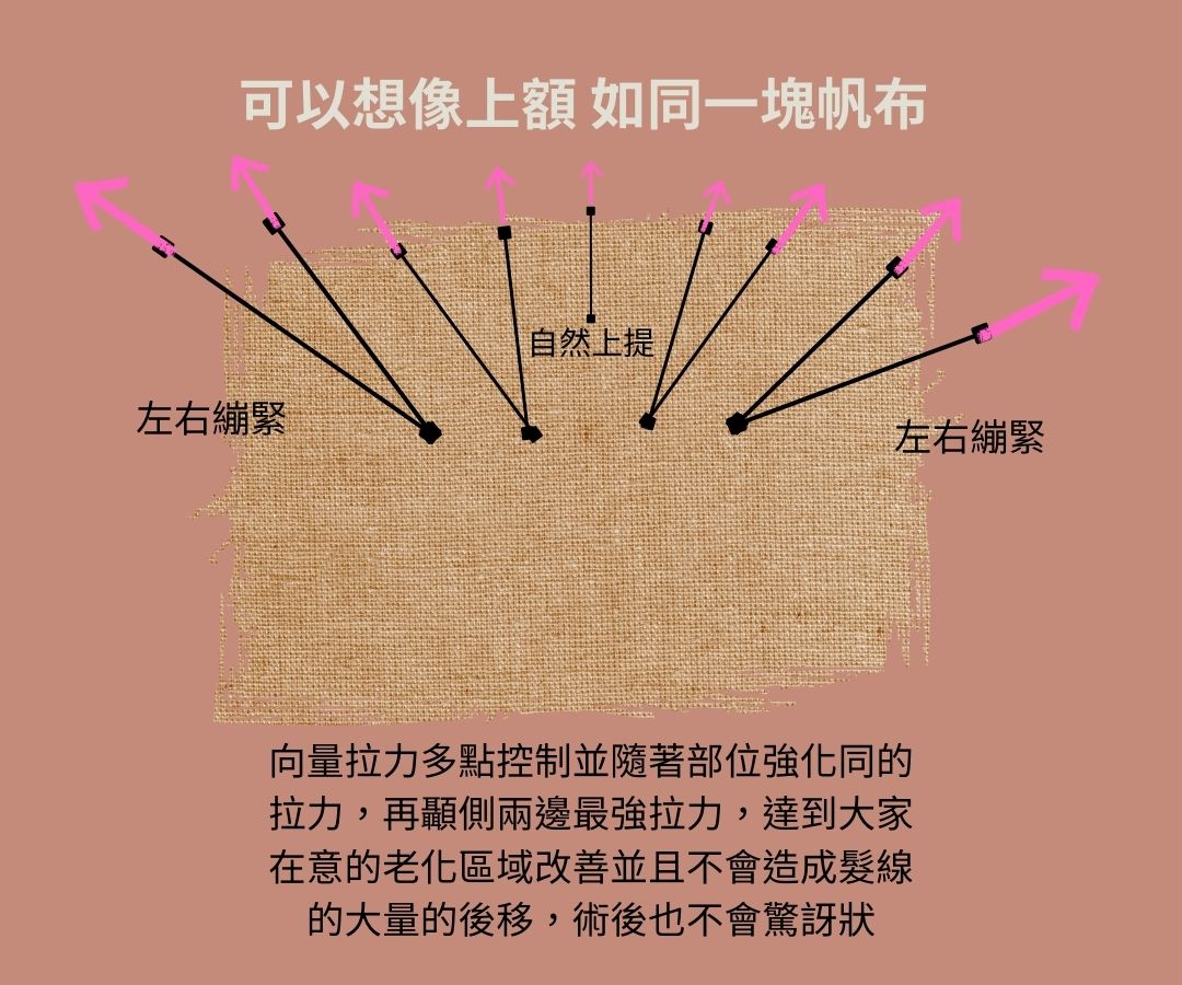 醫美,拉皮,下垂,鬆弛,保養,凡登,雙眼皮,拉皮手術,臉部拉皮,腹部拉皮,醫美拉皮,皮膚鬆弛,皮膚鬆,羅國銓醫師,杜隆成醫師,整形外科,整外醫師,整外醫師推薦,醫美醫生推薦,醫美手術,台北醫美,拉皮手術術後,拉皮分享,荊偉政,埋線拉皮,埋線拉提,醫美埋線,馮中和,凡登醫美,蕭弘道,韓國拉皮,韓國醫美,蘋果肌下垂,老化下垂,臉頰下垂,嘴邊肉,嘴邊肉醫美,嘴邊肉行成,新式拉皮,無痛拉皮,傳統拉皮,拉皮傷口,拉皮縫合,電波拉皮,音波拉皮,拉皮開刀,拉皮醫生,拉皮推薦,拉皮診所,隱痕拉皮,客製拉皮,拉皮恢復期,周杰醫師,眼袋,天鵝頸拉皮,台北佳思優,拉皮權威,張光正,璞美,美麗線,佳飛雅醫美,群英,張世幸醫師,馬偕整形外科,HD內視鏡微創,凡登整形外科,胡岱霖醫師,內視鏡提眉,法喬醫美診所,馮中和院長,台灣拉皮權威,二次拉皮,顳側拉皮,新式顳側拉皮,電音雙波,中下臉拉皮,蕭正偉院長,晶美整形外科,美嘉美整形外科,BOGEN 博恩妍診所,張簡仕煌院長,