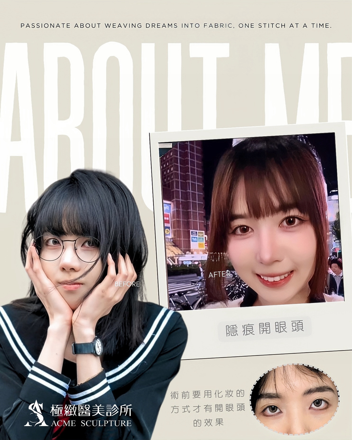 隱痕開眼頭 術前術後