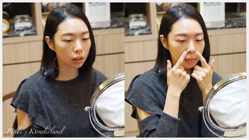 如何改善嘴邊肉、木偶紋、嬰兒肥? 第三代海芙音波拉提真實分享