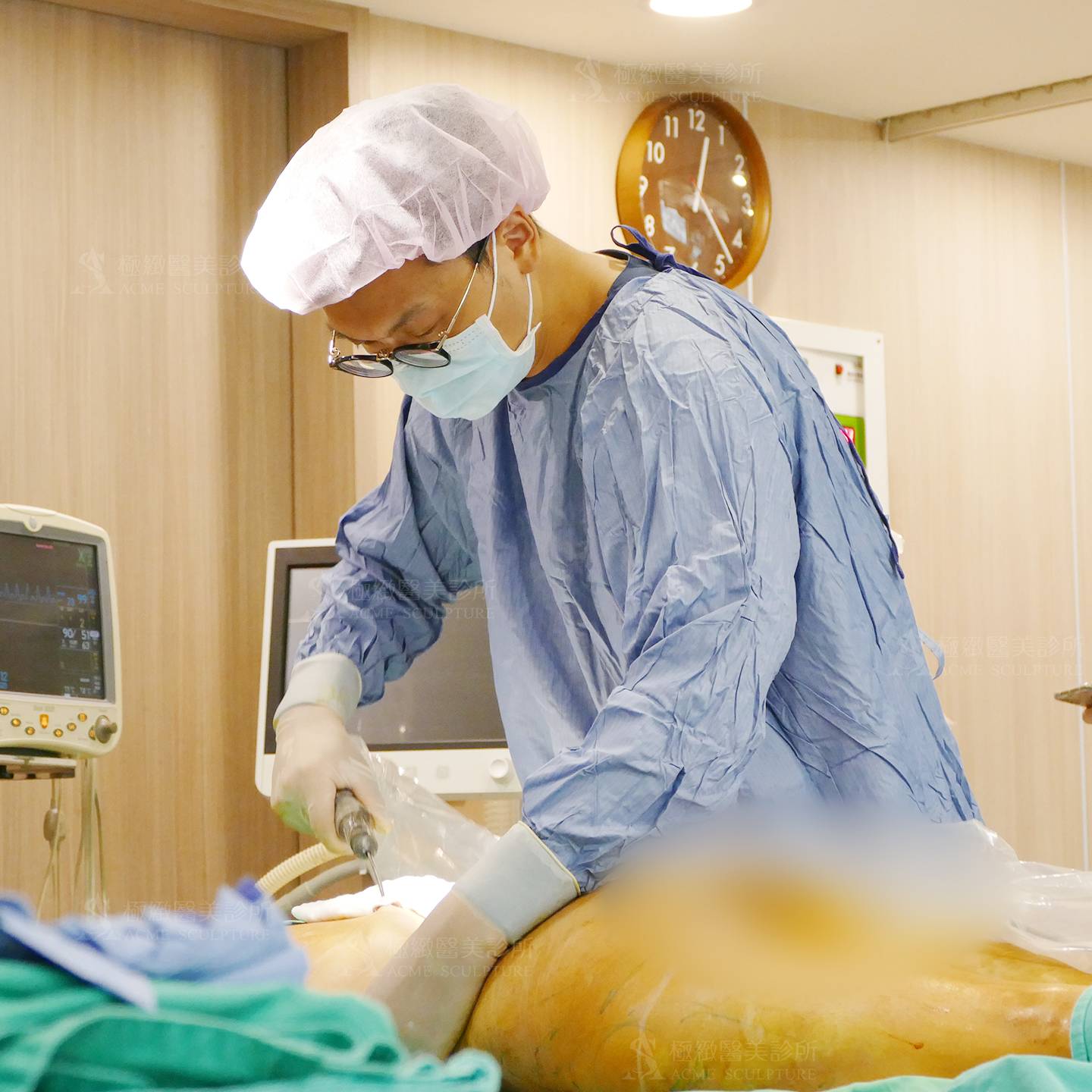 自體脂肪豐胸 追求勻稱的體態 自然的美胸 極緻醫美診所acme Sculpture Aesthetic Clinic